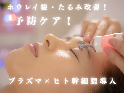 エピベル(Epibelle)の写真