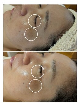 サロンドットブレスドットケイ(salon.bless.k)/【松江/出雲/安来】毛穴疲れ肌を