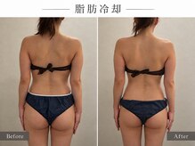 ポノピピ 小倉本店(ponopipi)の雰囲気（ヴィクトリアクライオ認定講師正規代理店痩身の講師！）