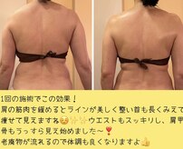 ハーボプラス(THE HEARBO plus)