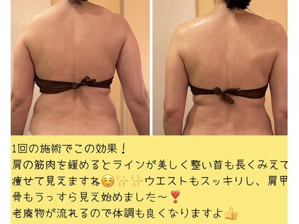 ハーボプラス(THE HEARBO plus)の写真