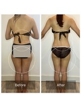 ウィズ ユー ビューティ(with U beauty)/別人級