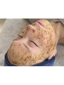 シミしわ改善！予防ケア