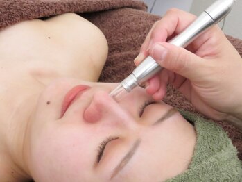 エースマイルイズ(A smile is..)の写真/【毛穴洗浄で肌質改善】気になる毛穴目立ちを徹底ケア！ワンランク上の肌を目指しましょう♪