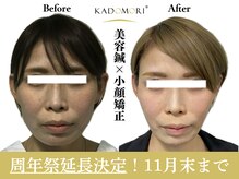 カドモリ 心斎橋(KADOMORI)