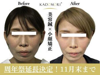 カドモリ 心斎橋(KADOMORI)