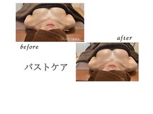 リリー(Lily)/バスト