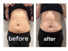 マキ(maki)の雰囲気（最新EMS痩身エムスレンダーで肌に触れずにインナーマッスル強化!）