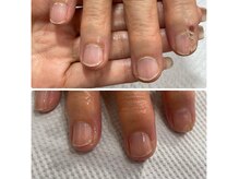 ココネイル 瑞穂店(coco nail)の雰囲気（ハンド/フットトラブルネイル/深爪育成/自爪育成実績多数！）