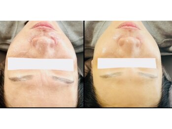 サロンモコ(Salon Moco)/