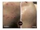 ヴェルデ 池袋西口店(Verde)の写真/マシンにこだわるエステ!プラズマ肌育ケアでニキビ・毛穴・くすみを徹底改善◎透明感あふれる水光美肌へ♪