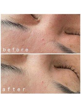 メナードフェイシャルサロン 岐阜茜部/お肌を元気にビタミンパック