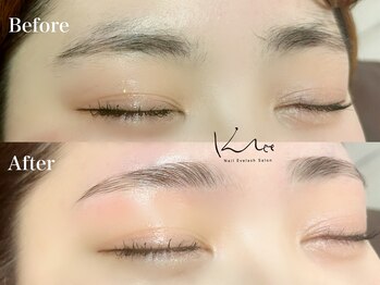 クレー(Klee)/アイブロウリフト