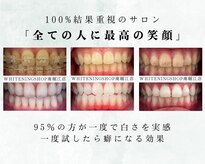 ホワイトニングショップ 長崎店