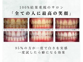 ホワイトニングショップ 長崎店
