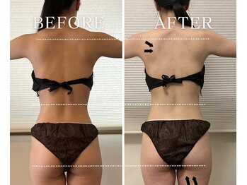 ヨサパーク アーバンヘブン 目黒(YOSA PARK Urban Heaven)/短期期間で集中ダイエット!