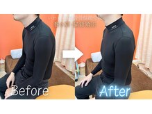 いわくら肩甲骨 骨盤接骨院BTG 一宮千秋/猫背矯正×巻き肩矯正