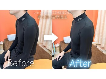 いわくら肩甲骨 骨盤接骨院BTG 一宮千秋/猫背矯正×巻き肩矯正