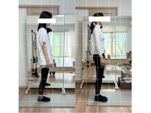 40代でもこの変化！綺麗になりたい女性は是非整体×ピラティスを