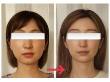 ミラクル(Miracle)/アフターの写真