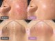 ベルーナビューティ 西新宿(Beluna beauty)の写真
