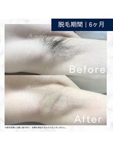 メンズクリア イオンタウン山梨中央店/【メンズクリア】お客様の施術例