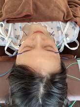 ハリファ鍼灸院 横浜関内院(HariFa鍼灸院)/美容施術