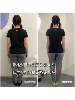 ナナ 吉祥寺店(NANA)/ビフォーアフター