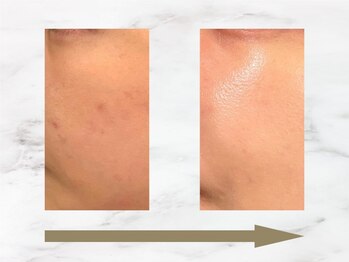 ハリロイヤル トーキョー武蔵小山/美しさは未来を変える。