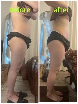 サニー(SUNNY)/アーユルキャビテーションコース