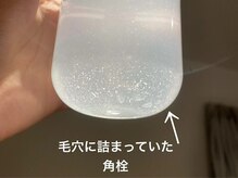 セレブリボーン 大阪ボーテ/ハイドロ毛穴洗浄