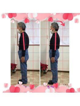 カイロプラクティック コダマ(KODAMA)/腰痛