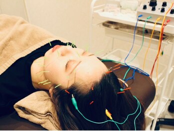 クマノミ美容鍼灸 銀座院(KUMANOMI美容鍼灸)の写真/《小顔矯正と美容鍼で骨格&筋膜からリフトUP》独自の手技の小顔矯正と美容鍼をSETでご提供!土台から小さく!