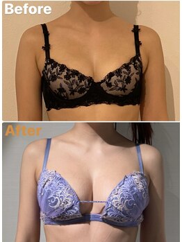 ラビス(RAVIS)/C→Fカップ☆ハリとボリューム！