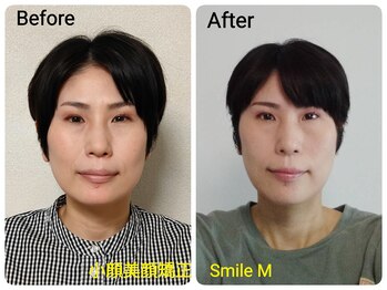 スマイルエム(SmileM)/