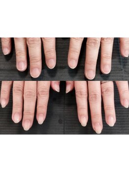 爪の悩みを解消できる（ケア含む）