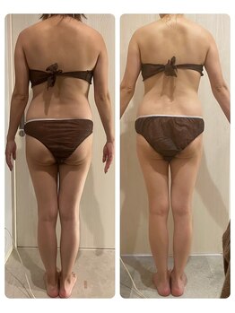 ナナイロ(nanairo)/筋膜リリースビフォーアフター