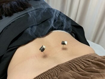 TK鍼灸院/全身リラックス◎