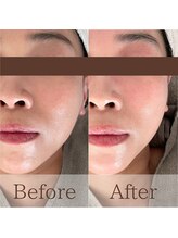 凪眠/小顔リンパフェイシャルの効果69