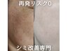 【40代以上限定】隠すシミから、“消す”シミへ【残2名】34,100→14,800