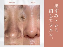 トリートメントサロンビューティープラス(Treatment Salon Beauty+)/