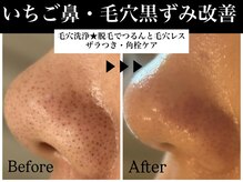 ビューティービレッジ(Beauty village)