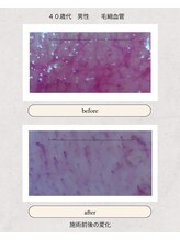 ぷめはな整体/before/After