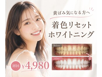 グリッター ショウナン(glitter. SHONAN)の写真/ホワイトニングが当たり前の時代だからこそ、結果を重視したい方へ!歯が白いだけで、第一印象もぐっとUP◎