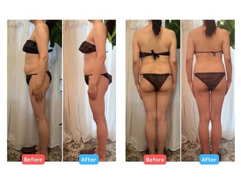 ソルーブ 広尾店/BeforeAfter