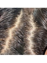 シュール センター南(SURREAL)/ヘッドスパ後のビフォーアフター