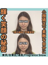 フレグランス スノウ 上野 湯島店(Fragrance Snow)/BeforeAfter1