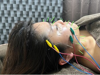 オレンジフラワープラス(orangeflower+)/美容鍼 見た目年齢-5歳へ