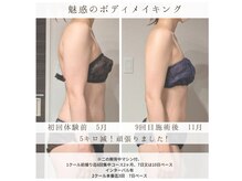 レディジュ 盛岡店(Ladyge)の雰囲気（マシン付なら脂肪燃焼効果も2倍◎短期集中やブライダルにもOK！）