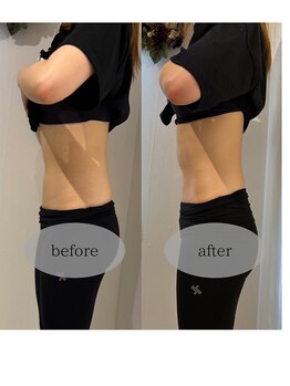 マホロバ セカンド(mahoroba 2nd)/くびれスッキリ腸マッサージ